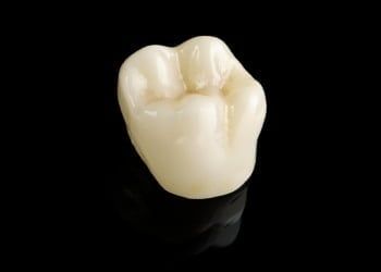 Coroa Dentária 3D de Porcelana para Estética