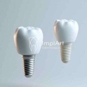 Implante dentário